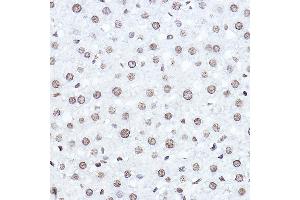 Immunohistochemistry of paraffin-embedded rat liver using SETD5 Rabbit pAb (ABIN6132960, ABIN6147644, ABIN6147646 and ABIN6223140) at dilution of 1:100 (40x lens). (SETD5 抗体  (AA 520-740))