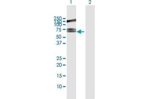 Western Blot analysis of RNF12 expression in transfected 293T cell line by RNF12 MaxPab polyclonal antibody. (RLIM 抗体  (AA 1-624))
