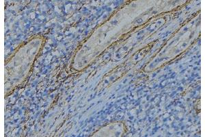 ABIN6274996 at 1/100 staining Human uterus tissue by IHC-P. (CBLN4 抗体  (Internal Region))