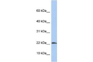 WB Suggested Anti-IL1B Antibody Titration: 0. (IL-1 beta 抗体  (N-Term))