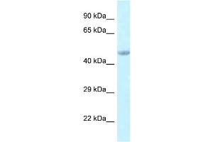 WB Suggested Anti-Eed Antibody   Titration: 1. (EED 抗体  (C-Term))