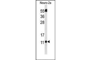 Western Blotting (WB) image for anti-SH3 Domain Binding Glutamic Acid-Rich Protein Like 3 (SH3BGRL3) (AA 31-60), (Middle Region) antibody (ABIN954790)