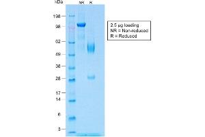 SDS-PAGE Analysis of Purified Wilm's Tumor Rabbit Recombinant Monoclonal Antibody (WT1/1434R). (Recombinant WT1 抗体)