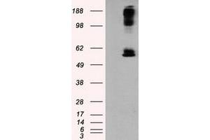HEK293T cells were transfected with the pCMV6-ENTRY control (Left lane) or pCMV6-ENTRY LIPG (Right lane) cDNA for 48 hrs and lysed. (LIPG 抗体)