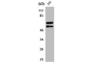 Western Blot analysis of 293 cells using Phospho-Lyn (Y508) Polyclonal Antibody (LYN 抗体  (pTyr508))
