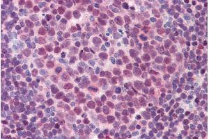 Immunohistochemistry (IHC) image for anti-Spleen Focus Forming Virus (SFFV) Proviral Integration Oncogene Spi1 (SPI1) (Internal Region) antibody (ABIN334471)