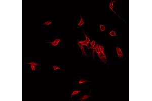 ABIN6267686 staining MDA-MB-435 by IF/ICC. (ASK1 抗体  (pSer966))