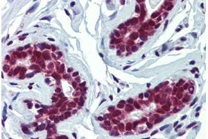 Immunohistochemistry (Formalin-fixed Paraffin-embedded Sections) (IHC (fp)) image for anti-Far Upstream Element (FUSE) Binding Protein 3 (FUBP3) (AA 503-552) antibody (ABIN6744454)