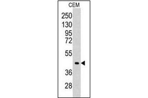 Western blot analysis of CEM cell line lysates (35 µg/lane). (ALDOC 抗体  (C-Term))