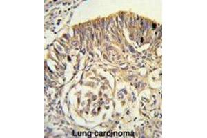 Immunohistochemistry (IHC) image for anti-Phospholipid Transfer Protein (PLTP) antibody (ABIN3003343) (PLTP 抗体)
