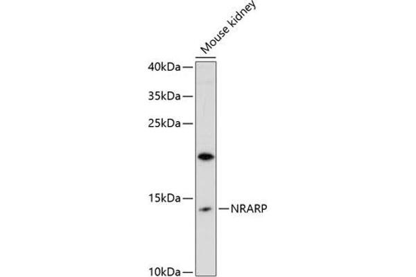 NRARP 抗体  (AA 1-114)