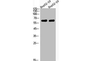 Western Blot analysis of HepG2-UV cells using Acetyl-Cortactin (K235) Polyclonal Antibody (Cortactin 抗体  (acLys235))