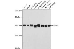 Western blot analysis of extracts of various cell lines, using VD antibody (ABIN7271337) at 1:500 dilution. (VDAC2 抗体  (AA 1-100))