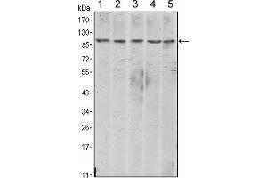 Western blot analysis using CDH2 mouse mAb against A431 (1), NIH/3T3 (2), Hela (3), C6 (4) and LNCap (5) cell lysate. (N-Cadherin 抗体)