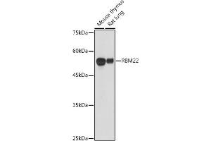 Western blot analysis of extracts of various cell lines, using RBM22 antibody (ABIN6127306, ABIN6146767, ABIN6146768 and ABIN6214130) at 1:1000 dilution. (RBM22 抗体  (AA 1-230))