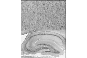 Adult rat cerebral cortex and hippocampus immunohistochemistry with antigen retrieval via pepsin pretreatment. (SPTBN4 抗体  (C-Term))
