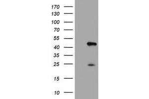 Western Blotting (WB) image for anti-Centromere Protein H (CENPH) antibody (ABIN1497474) (CENPH 抗体)