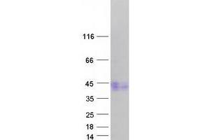 Validation with Western Blot
