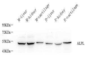 Western Blot analysis of various samples using ALPL Polyclonal Antibody at dilution of 1:1000. (ALPL 抗体)