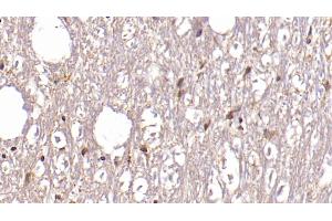 Detection of ASPH in Human Cerebellum Tissue using Monoclonal Antibody to Aspartate Beta Hydroxylase (ASPH)