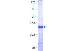 TINF2 Protein (AA 256-354) (GST tag)