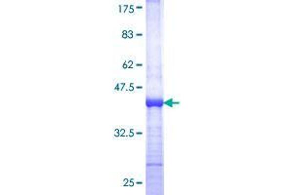 TINF2 Protein (AA 256-354) (GST tag)