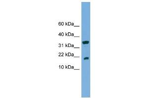 WB Suggested Anti-ACP1  Antibody Titration: 0. (ACP1 抗体  (Middle Region))