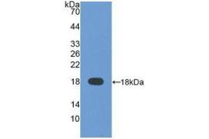 WB of Protein Standard: different control antibodies against Highly purified E. (alpha Fetoprotein CLIA Kit)