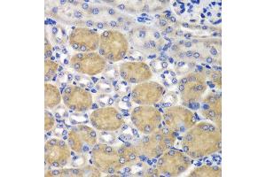 Immunohistochemistry of paraffin-embedded mouse kidney using SND1 antibody at dilution of 1:100 (40x lens). (SND1 抗体)