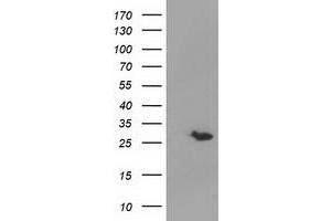 Western Blotting (WB) image for anti-Glutathione S-Transferase theta 2 (GSTT2) antibody (ABIN1498554) (GSTT2 抗体)