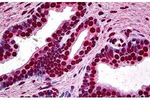 Human Prostate: Formalin-Fixed, Paraffin-Embedded (FFPE) (MEF2A 抗体  (AA 71-170))
