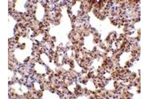 Immunohistochemistry (IHC) image for anti-Transient Receptor Potential Cation Channel, Subfamily C, Member 6 (TRPC6) (C-Term) antibody (ABIN1030779)