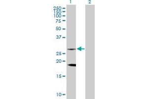 Western Blot analysis of CLTB expression in transfected 293T cell line by CLTB MaxPab rabbit polyclonal antibody. (CLTB 抗体  (AA 1-211))