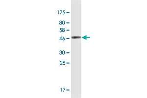 Western Blot detection against Immunogen (42 KDa) . (SPANXN3 抗体  (AA 1-141))