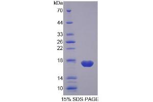 SDS-PAGE analysis of Pig FABP2 Protein. (FABP2 蛋白)
