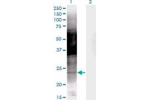 Western Blot analysis of PRKCDBP expression in transfected 293T cell line by PRKCDBP monoclonal antibody (M04), clone 8D3. (PRKCDBP 抗体  (AA 161-261))