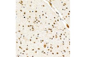 Immunohistochemistry of paraffin embedded mouse cerebellum using USP27 (ABIN7076113) at dilution of 1:700 (400x lens) (USP27X 抗体)