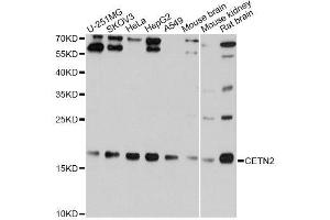 Western blot analysis of extracts of various cell lines, using CETN2 Antibody. (CETN2 抗体  (AA 1-172))