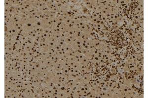 ABIN6274025 at 1/100 staining Mouse liver tissue by IHC-P. (MYB 抗体  (C-Term))