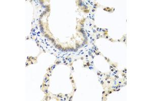 Immunohistochemistry of paraffin-embedded rat lung using DEDD antibody (ABIN5973422) at dilution of 1/100 (40x lens). (DEDD 抗体)