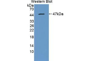 Detection of Recombinant MTTP, Mouse using Polyclonal Antibody to Microsomal Triglyceride Transfer Protein (MTTP) (MTTP 抗体  (AA 28-459))