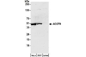 Western Blotting (WB) image for anti-Acyl-CoA Thioesterase 9 (Acot9) (AA 389-439) antibody (ABIN7452801)