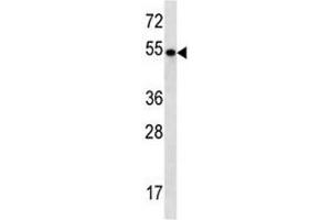 TBC1D3E antibody western blot analysis in NCI-H292 lysate (TBC1D3E (AA 498-527) 抗体)