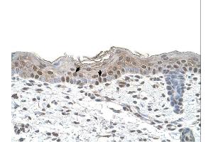 Arrestin B2 antibody was used for immunohistochemistry at a concentration of 4-8 ug/ml. (Arrestin 3 抗体  (Middle Region))