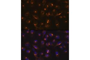 Immunofluorescence analysis of U-2 OS cells using RA Rabbit mAb (ABIN7269792) at dilution of 1:100 (40x lens). (RAB11A 抗体)