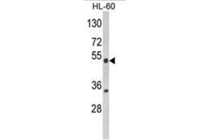 Western blot analysis of NR1I2 Antibody (Center) in HL-60 cell line lysates (35ug/lane). (NR1I2 抗体  (Middle Region))