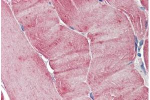 Human Skeletal Muscle: Formalin-Fixed, Paraffin-Embedded (FFPE) (Aurora A 抗体)