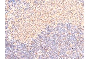 ABIN6267289 at 1/100 staining rat spleen cancer tissue sections by IHC-P. (p53 抗体  (pSer15))