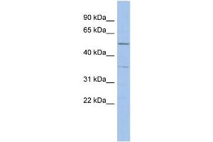 WB Suggested Anti-ABHD15 Antibody Titration: 0. (ABHD15 抗体  (Middle Region))