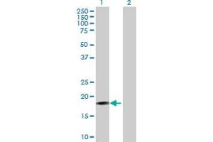 Western Blot analysis of PIGH expression in transfected 293T cell line by PIGH MaxPab polyclonal antibody. (PIGH 抗体  (AA 1-188))